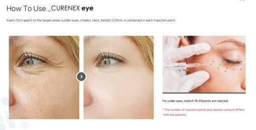 CURENEX Eye - Image 3